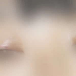 両まぶたヤバいの写真1枚目