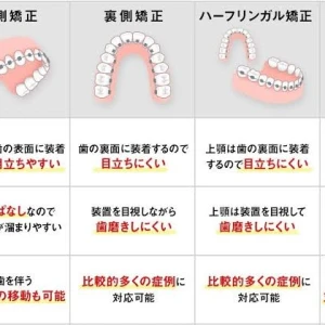 矯正の写真3枚目