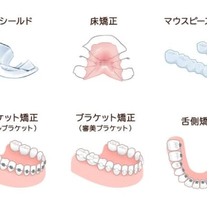 矯正の写真2枚目