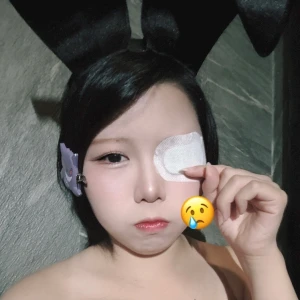 おめめ…😢の写真1枚目