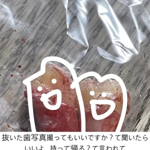 抜歯の写真1枚目