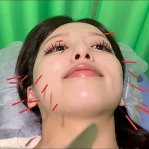 鍼！の写真1枚目